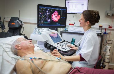 editorial use only  
Dobutamine echocardiography or stress echography, a non-invasive screening for coronary heart disease, cardiology hospital of Bordeaux Hospital, France.